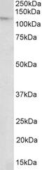 Electron Transfer Flavoprotein Subunit Beta antibody, 42-808, ProSci, Western Blot image 