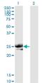 Noggin antibody, H00009241-M11, Novus Biologicals, Western Blot image 