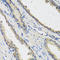 RAD51 Paralog C antibody, LS-C346156, Lifespan Biosciences, Immunohistochemistry frozen image 