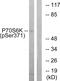Ribosomal Protein S6 Kinase B2 antibody, PA5-38307, Invitrogen Antibodies, Western Blot image 