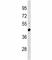 Plasminogen Activator, Urokinase antibody, F52084-0.4ML, NSJ Bioreagents, Western Blot image 
