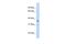 Sarcoglycan Gamma antibody, PA5-42546, Invitrogen Antibodies, Western Blot image 