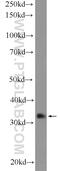 General Transcription Factor IIH Subunit 3 antibody, 19869-1-AP, Proteintech Group, Western Blot image 