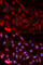 Proteasome Activator Subunit 1 antibody, A5358, ABclonal Technology, Immunofluorescence image 