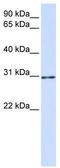 AKT1 Substrate 1 antibody, TA346509, Origene, Western Blot image 