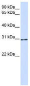 AKT1 Substrate 1 antibody, TA346509, Origene, Western Blot image 