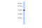 Nuclear Receptor Subfamily 2 Group E Member 1 antibody, 25-044, ProSci, Enzyme Linked Immunosorbent Assay image 