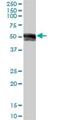 Immunoglobulin Heavy Constant Gamma 1 (G1m Marker) antibody, H00003500-B01P, Novus Biologicals, Western Blot image 