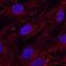 Integrin Subunit Beta 5 antibody, AF3824, R&D Systems, Western Blot image 