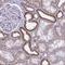 Autophagy Related 9A antibody, NBP2-32477, Novus Biologicals, Immunohistochemistry paraffin image 