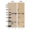 Carcinoembryonic Antigen Related Cell Adhesion Molecule 1 antibody, M00923-1, Boster Biological Technology, Western Blot image 