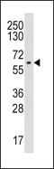 Cytochrome P450 Family 19 Subfamily A Member 1 antibody, 62-799, ProSci, Western Blot image 