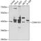 Casein Kinase 1 Gamma 1 antibody, 22-994, ProSci, Western Blot image 