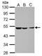 Atypical Chemokine Receptor 3 antibody, PA5-28739, Invitrogen Antibodies, Western Blot image 