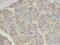 Carnitine O-palmitoyltransferase 1, liver isoform antibody, LS-C333970, Lifespan Biosciences, Immunohistochemistry frozen image 