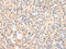 Vasohibin 1 antibody, CSB-PA562311, Cusabio, Immunohistochemistry paraffin image 