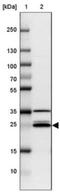 Vesicle Transport Through Interaction With T-SNAREs 1A antibody, NBP2-30952, Novus Biologicals, Western Blot image 