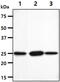 N-Ribosyldihydronicotinamide:Quinone Reductase 2 antibody, MBS200187, MyBioSource, Western Blot image 