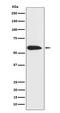 Keratin 6A antibody, M04012-1, Boster Biological Technology, Western Blot image 