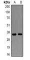 Amphiregulin antibody, abx225043, Abbexa, Western Blot image 