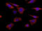 S100 Calcium Binding Protein A8 antibody, MBS602107, MyBioSource, Immunocytochemistry image 