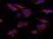 S100 Calcium Binding Protein A8 antibody, MBS602107, MyBioSource, Immunocytochemistry image 