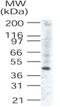 Tribbles Pseudokinase 3 antibody, GTX42107, GeneTex, Western Blot image 