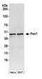 Flap Structure-Specific Endonuclease 1 antibody, A300-256A, Bethyl Labs, Western Blot image 