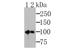 MutS Homolog 2 antibody, NBP2-76895, Novus Biologicals, Western Blot image 