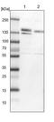 Ataxin 2 antibody, PA5-54336, Invitrogen Antibodies, Western Blot image 