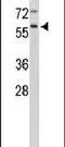 Cathepsin F antibody, PA5-13511, Invitrogen Antibodies, Western Blot image 