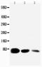 Epidermal Growth Factor antibody, PA1398, Boster Biological Technology, Western Blot image 