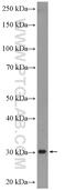 VPS28 Subunit Of ESCRT-I antibody, 15478-1-AP, Proteintech Group, Western Blot image 