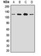 Spliceosome Associated Factor 1, Recruiter Of U4/U6.U5 Tri-SnRNP antibody, LS-C668106, Lifespan Biosciences, Western Blot image 