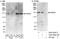 Rho GTPase Activating Protein 29 antibody, A301-924A, Bethyl Labs, Western Blot image 