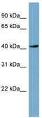 Testis Specific Serine Kinase 2 antibody, TA335413, Origene, Western Blot image 