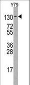 ABL Proto-Oncogene 2, Non-Receptor Tyrosine Kinase antibody, LS-C155889, Lifespan Biosciences, Western Blot image 