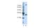 Serine And Arginine Rich Splicing Factor 10 antibody, NBP1-57428, Novus Biologicals, Western Blot image 