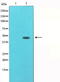 Tubulin Gamma 1 antibody, TA325962, Origene, Western Blot image 