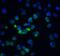 Apoptotic Chromatin Condensation Inducer 1 antibody, 2215, ProSci, Immunofluorescence image 