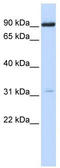 Cholinergic Receptor Nicotinic Alpha 4 Subunit antibody, TA330422, Origene, Western Blot image 