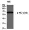 Neurofibromin 2 antibody, PA5-40266, Invitrogen Antibodies, Western Blot image 