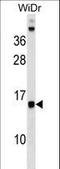 Defender Against Cell Death 1 antibody, LS-C159436, Lifespan Biosciences, Western Blot image 