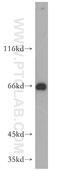 MAPK Associated Protein 1 antibody, 15463-1-AP, Proteintech Group, Western Blot image 