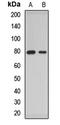 Acyl-CoA Synthetase Long Chain Family Member 4 antibody, orb412494, Biorbyt, Western Blot image 