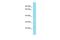 Chromosome 8 Open Reading Frame 82 antibody, A18368, Boster Biological Technology, Western Blot image 