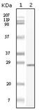 c-Kit antibody, AM06162SU-N, Origene, Western Blot image 