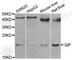 Gastric inhibitory polypeptide antibody, A6230, ABclonal Technology, Western Blot image 