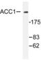Acetyl-CoA Carboxylase Alpha antibody, LS-C176257, Lifespan Biosciences, Western Blot image 