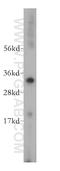 Voltage Dependent Anion Channel 2 antibody, 11663-1-AP, Proteintech Group, Western Blot image 